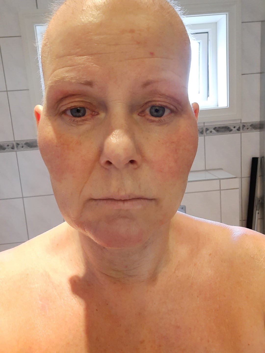 Kathe kunne ikke kjenne seg selv igjen da kreft tok overhånd.