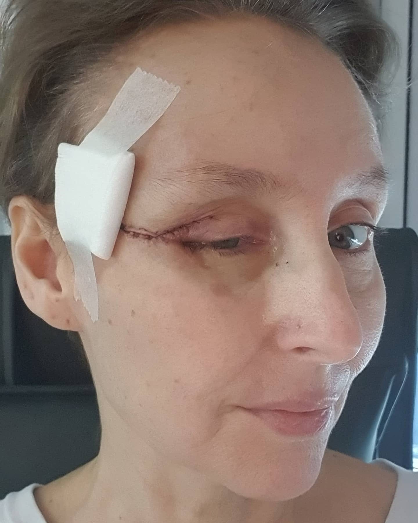 Elisabeth er veldig åpen om diagnosen sin, og ønsker å belyse utfordringene rundt krefttypen sin.